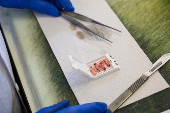 Een weefselstaal wordt voorbereid voor onderzoek